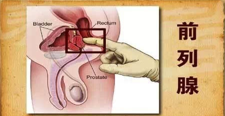 前列腺痛,前列腺痛原因,阜阳前列腺痛原因